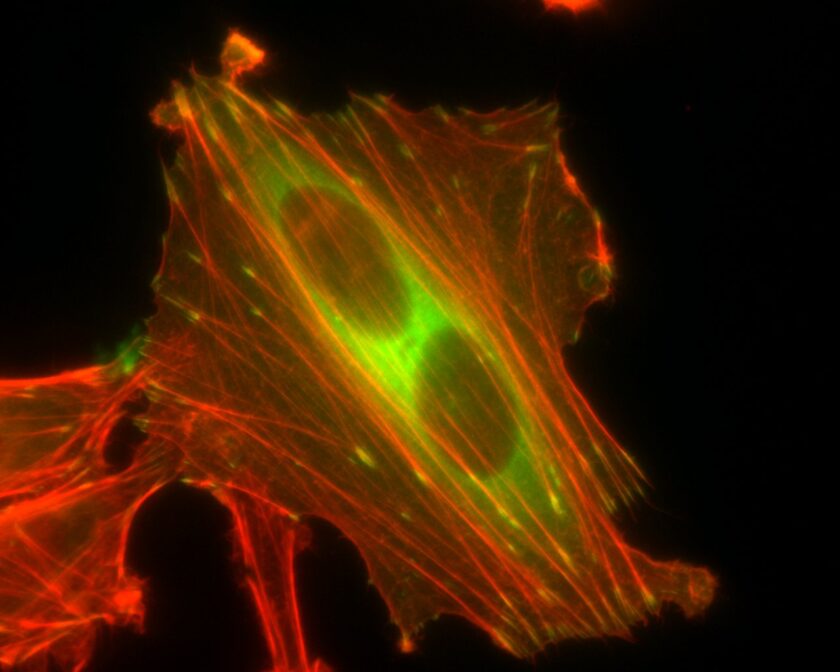Fibroblast stained for paxillin (green) & F-actin (red) 