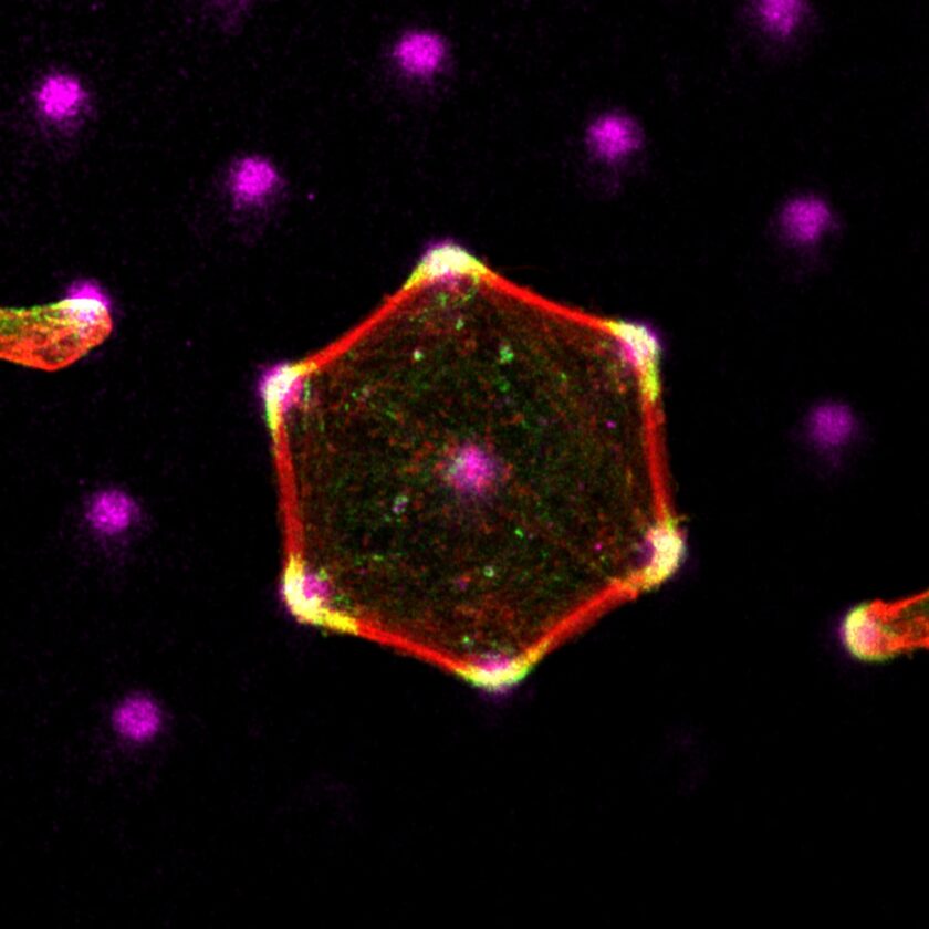 Fibroblast plated on fibronectin micro-patterns (magenta), stained for paxillin (green) & F-actin (red)
